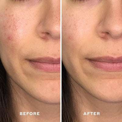 Green T. Infusion Gel Mask (x4) - Aceology Beauty US