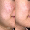 Detoxifying Treatment Mask - Aceology Beauty US