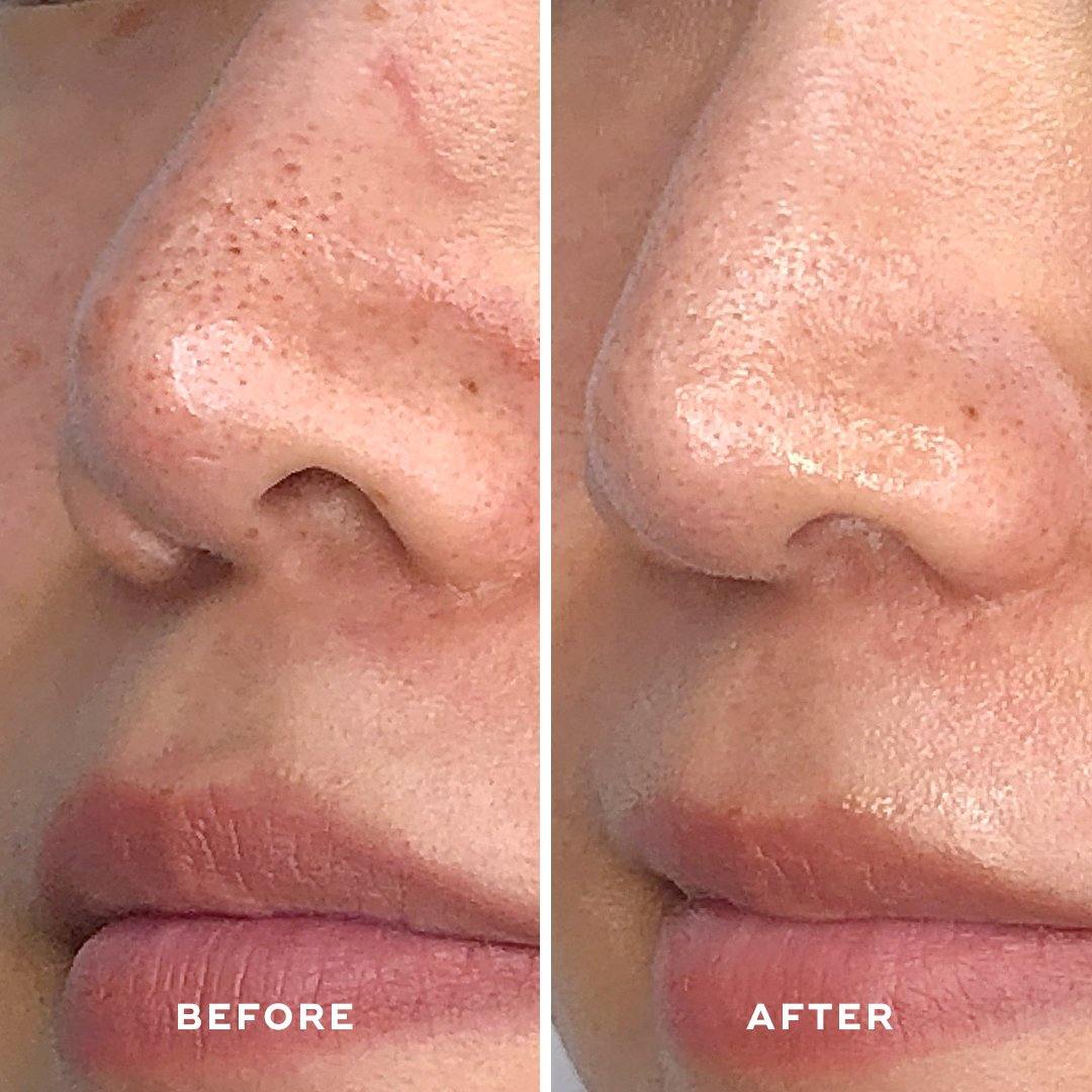 Detoxifying Treatment Mask - Aceology Beauty US