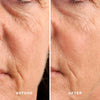 Lifting Treatment Mask - Aceology Beauty US